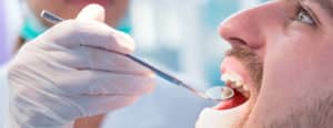 Tipos de caries dental y su tratamiento