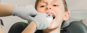 Brackets para niños - Clínica dental Els 15