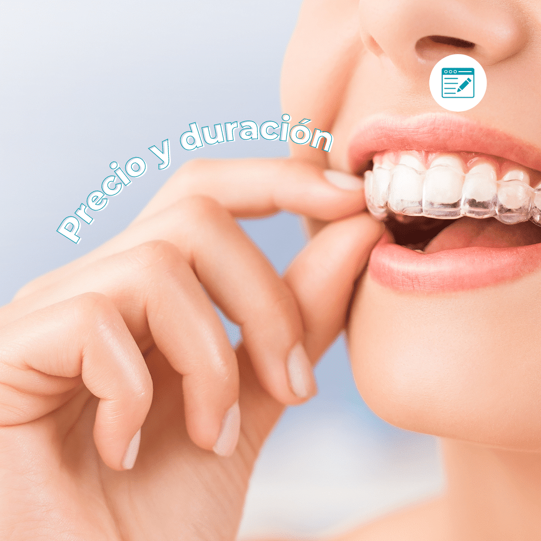 Duración y precio ortodoncia invisible - Centre Odontològic Els Quinze