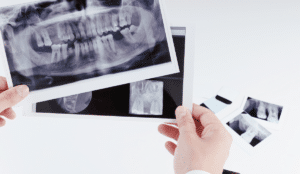 Tratamiento Odontología Conservadora - Els Quinze