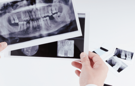 Tratamiento Odontología Conservadora - Els Quinze