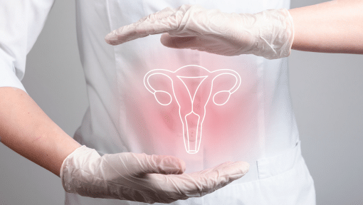 Síndrome Ovario Poliquístico - Els Quinze