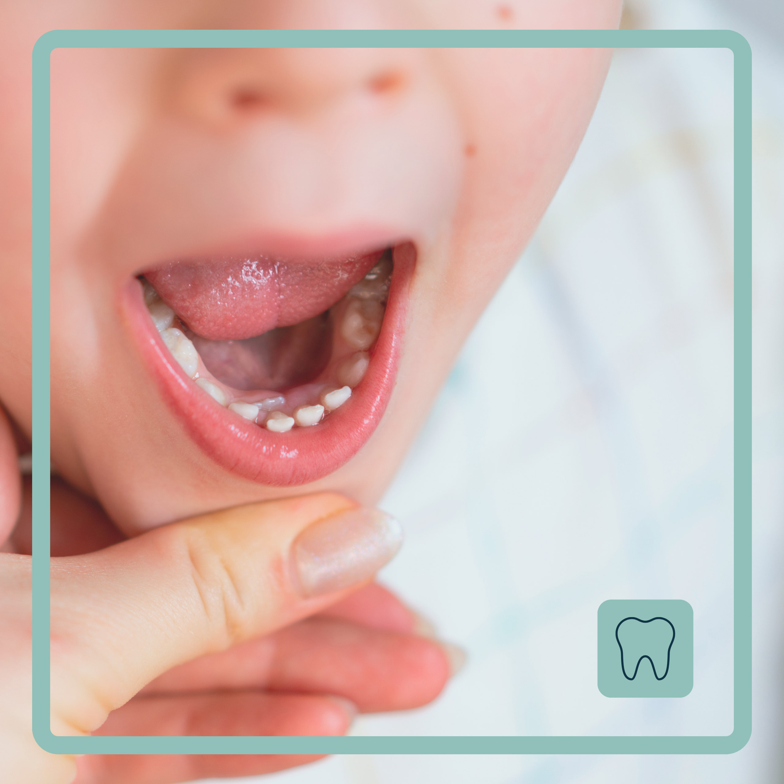 Dentición en niños - Dentició en nens